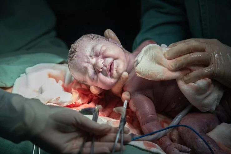 Neonatal Surgery in Bangalore